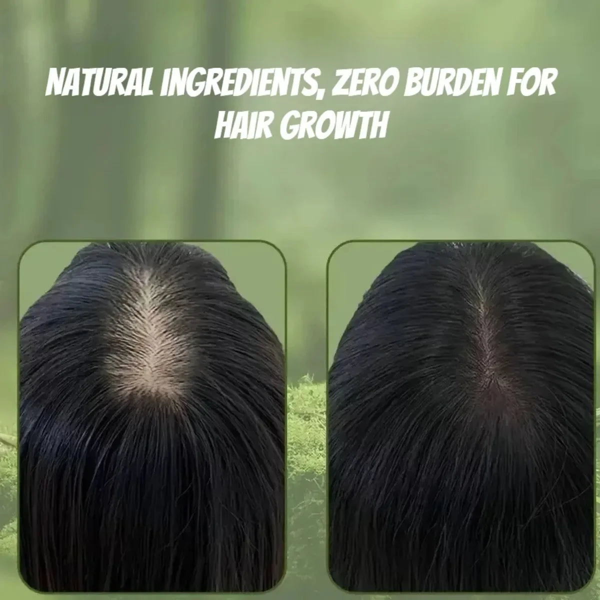RootVital Hair Essence – Strength &amp; Renewal